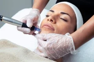 Dermapen uygulaması yapılıyor