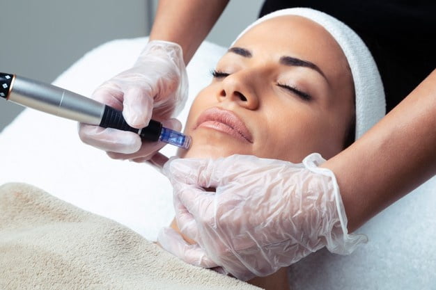 Dermapen uygulaması yapılıyor